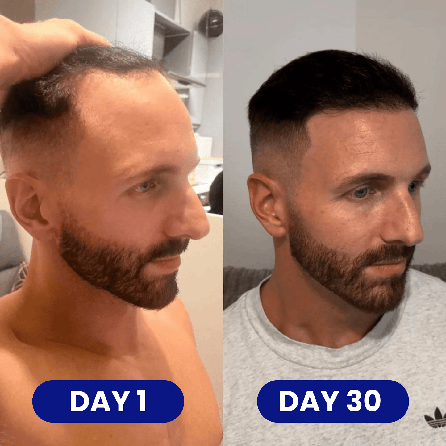Scalp - Hair Growth Serum
