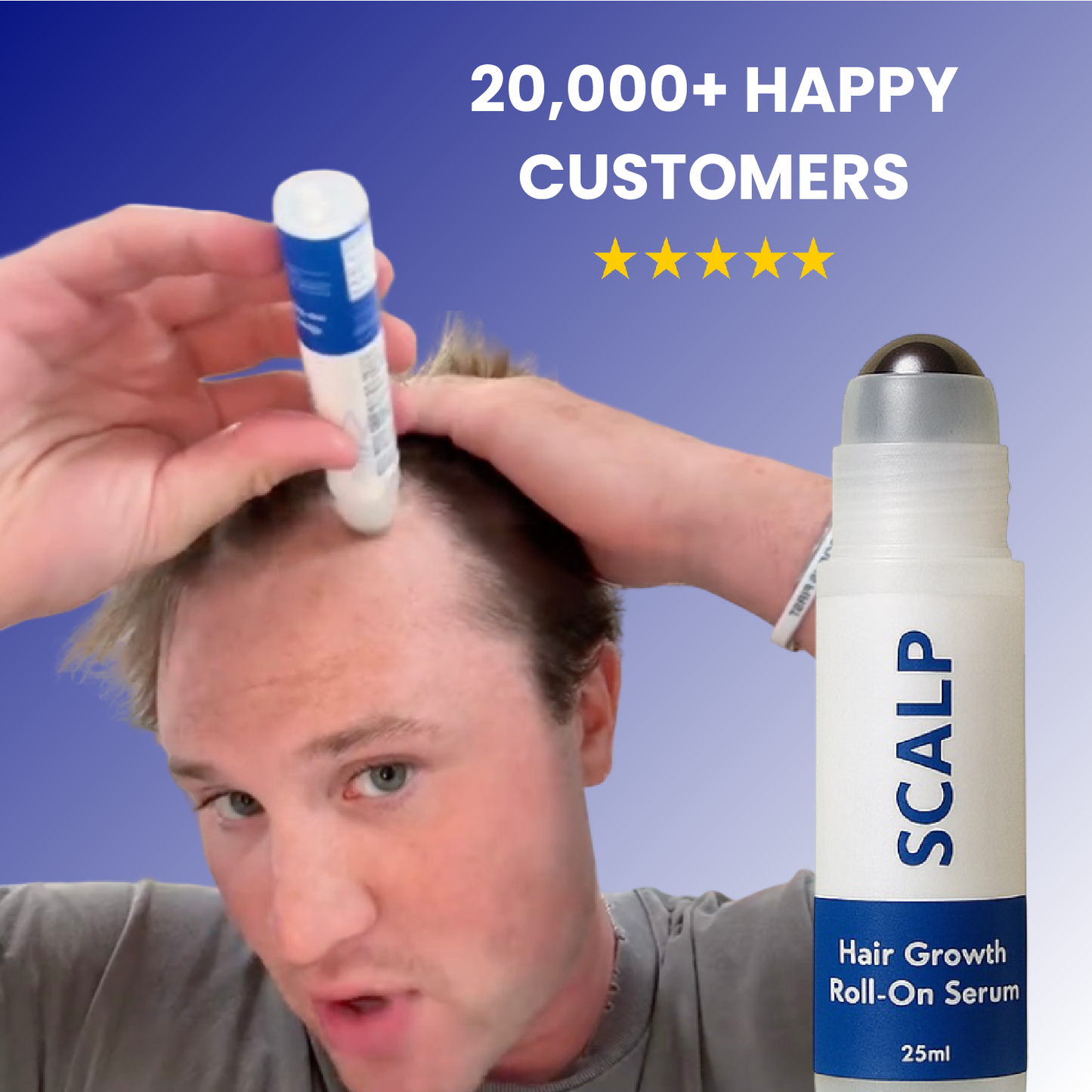 Scalp - Hair Growth Serum