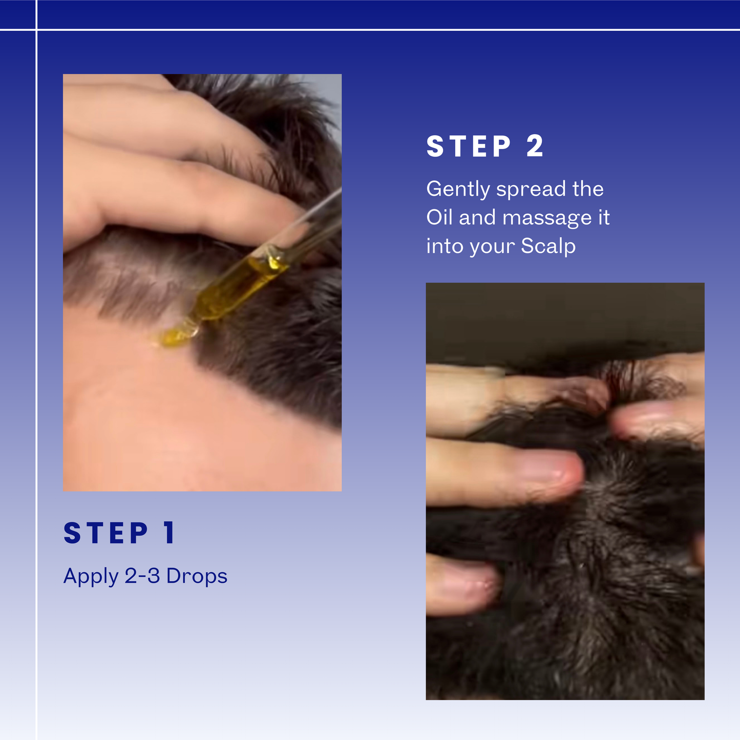 Scalp 2.0 - Advanced Hair Growth Serum