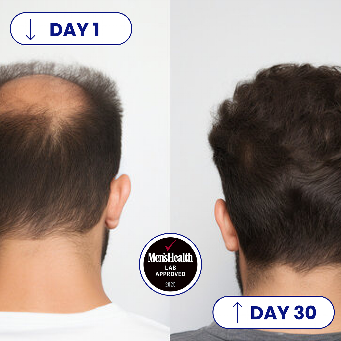 Scalp 2.0 - Advanced Hair Growth Serum