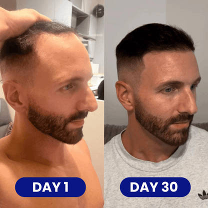 Scalp - Hair Growth Serum